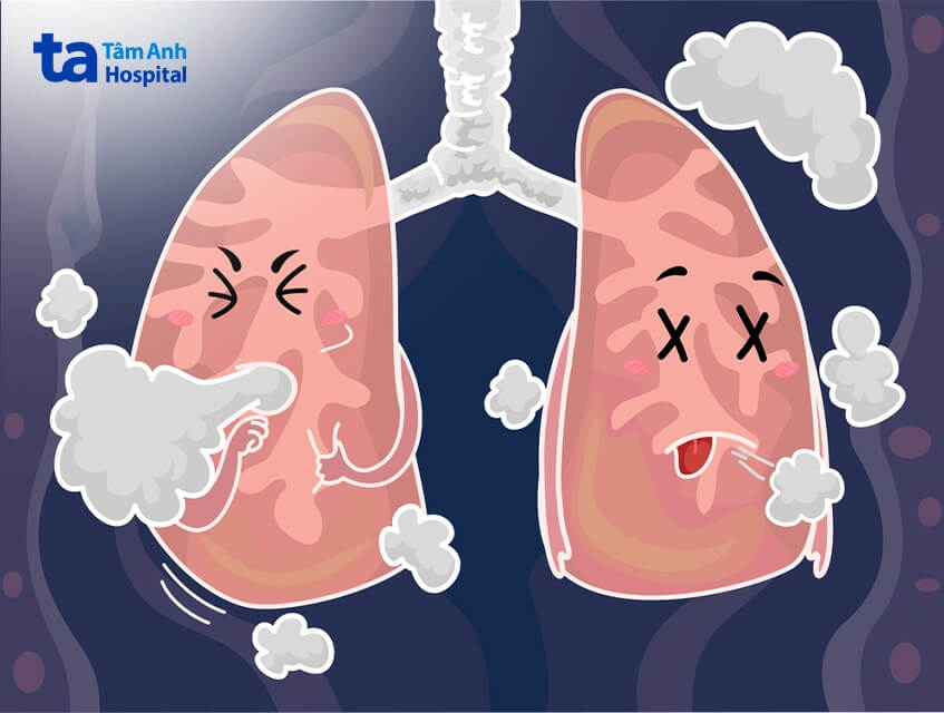 dấu hiệu người bị ngạt khói