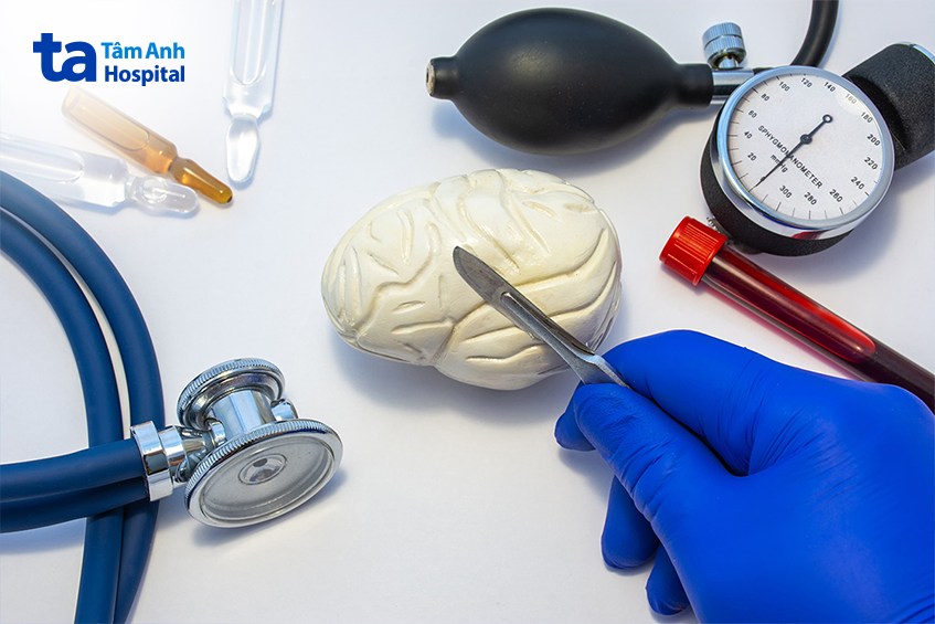Đột quỵ tuyến yên cần được theo dõi