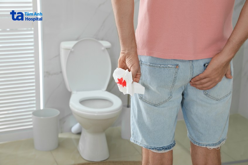 khi nào cần siêu âm trực tràng