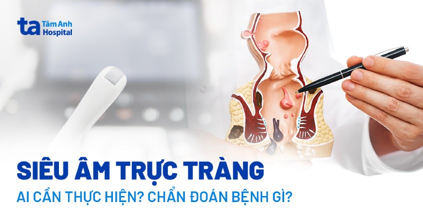 kỹ thuật siêu âm trực tràng