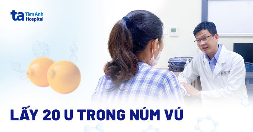 Lấy 20 u khỏi núm vú