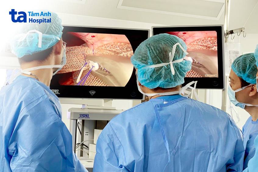 mổ xoắn lá lách