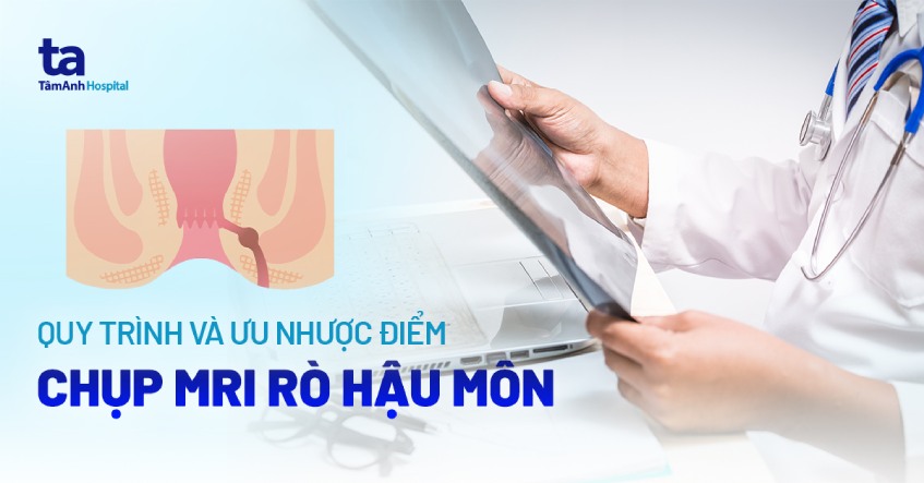 mri rò hậu môn
