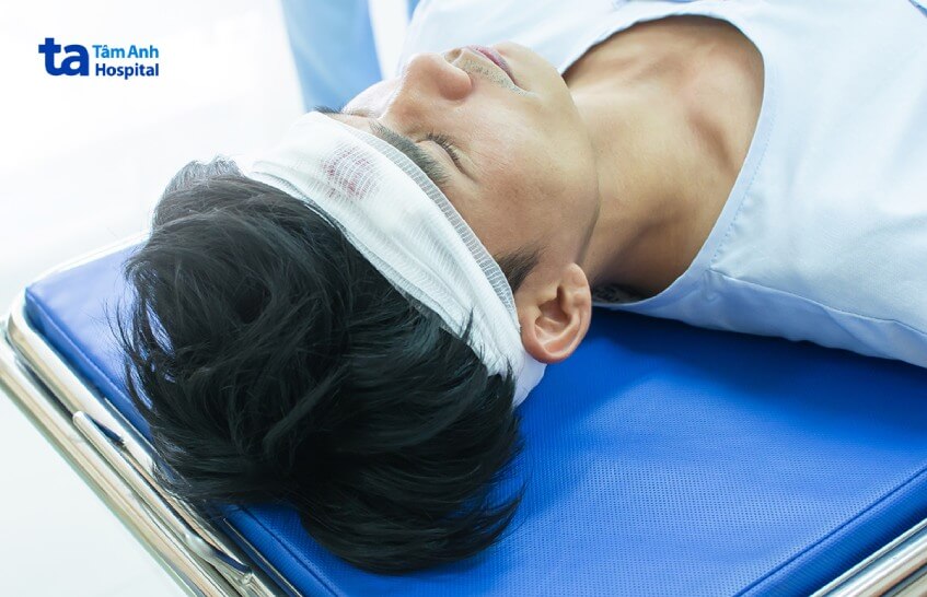 nguyên nhân chứng ngủ rũ