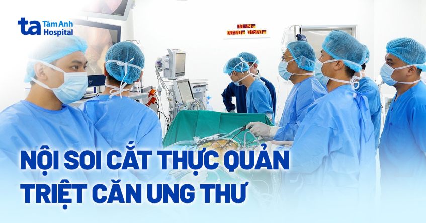 Phẫu thuật nội soi hoàn toàn cắt thực quản triệt căn ung thư