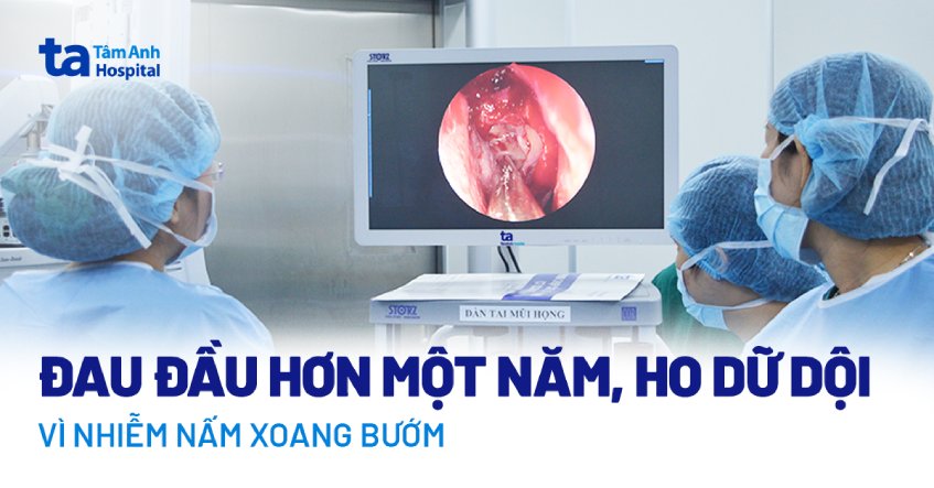 Ổ nấm xoang khiến người đàn ông đau đầu hơn một năm