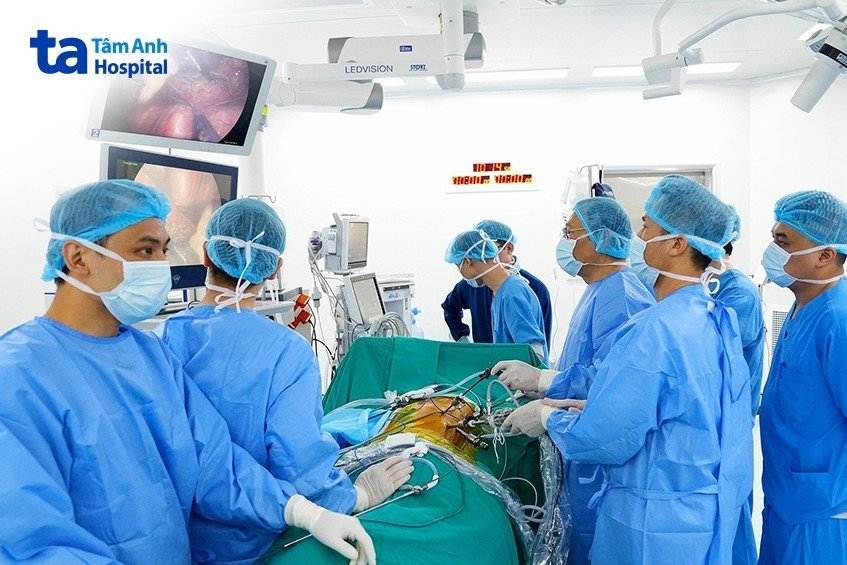 phẫu thuật nội soi cắt thực quản