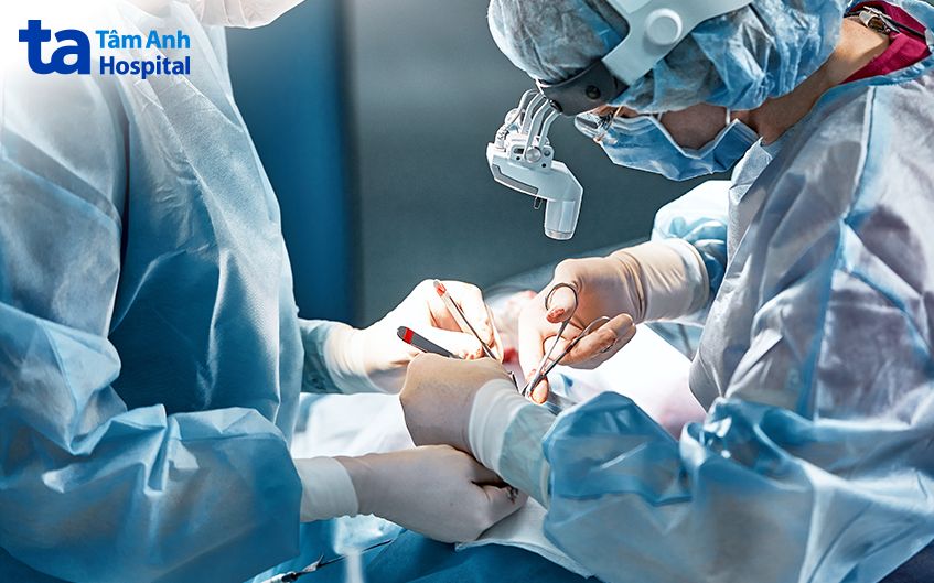 phẫu thuật ruột thừa