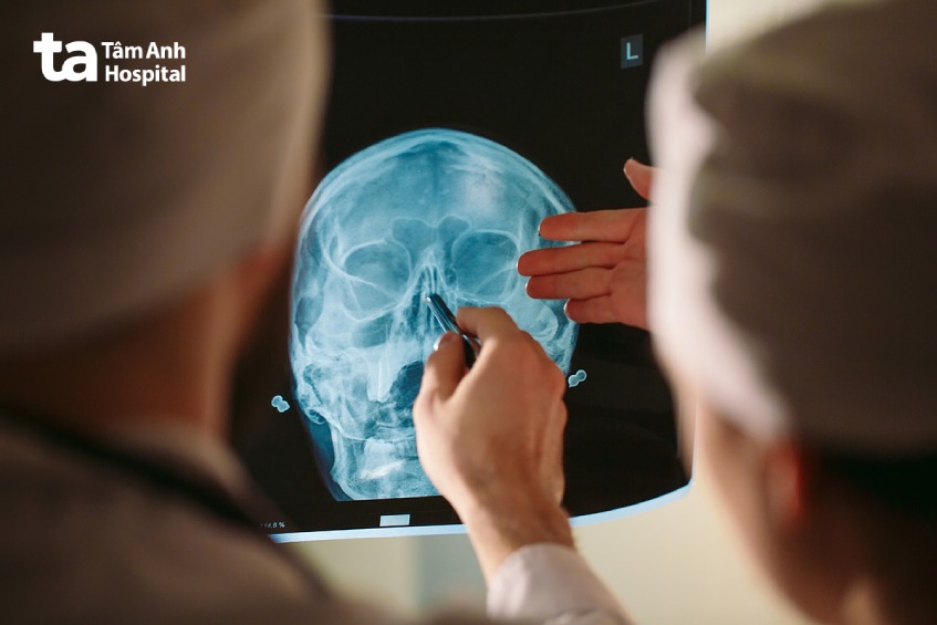 quy trình chụp x quang xoang