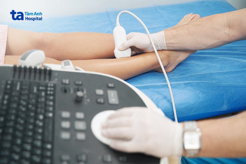 siêu âm duplex là gì