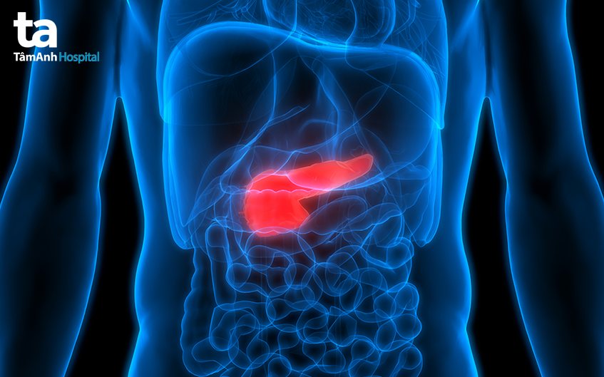 siêu âm tụy phát hiện bệnh gì