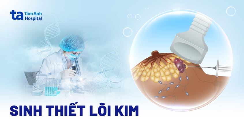 Sinh thiết lõi kim