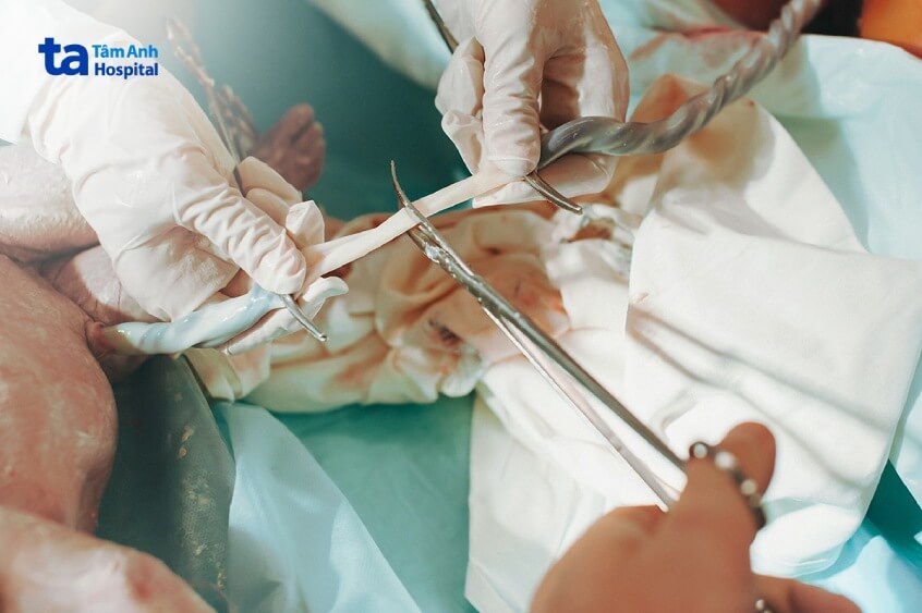 thu thập máu cuống rốn trẻ sơ sinh