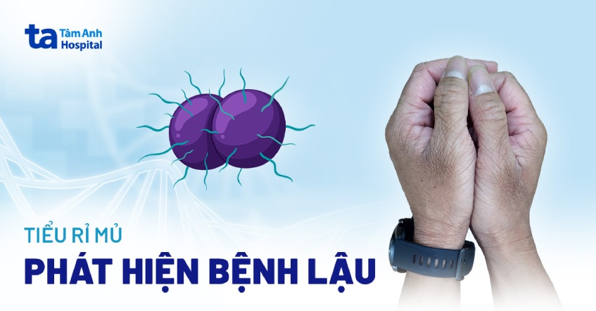 Phát hiện bệnh lậu khi đi tiểu rỉ mủ