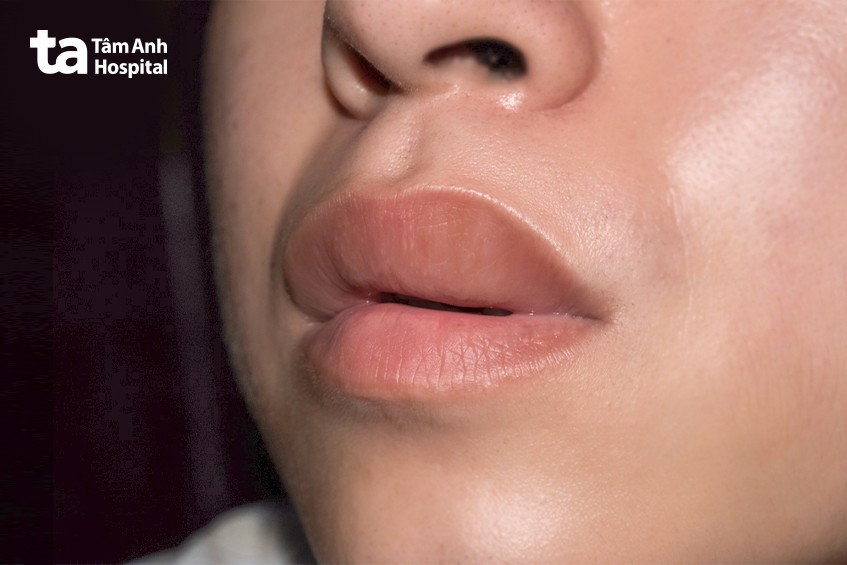 khi nào cần gặp bác sĩ