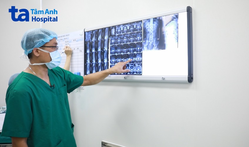 Bác sĩ Tri đánh giá kết quả chụp MRI của người bệnh trước ca phẫu thuật. Ảnh: Bệnh viện Đa khoa Tâm Anh