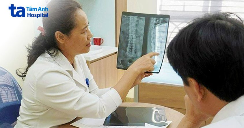 Phát hiện viêm cột sống dính khớp sau 20 năm chẩn đoán nhầm bệnh