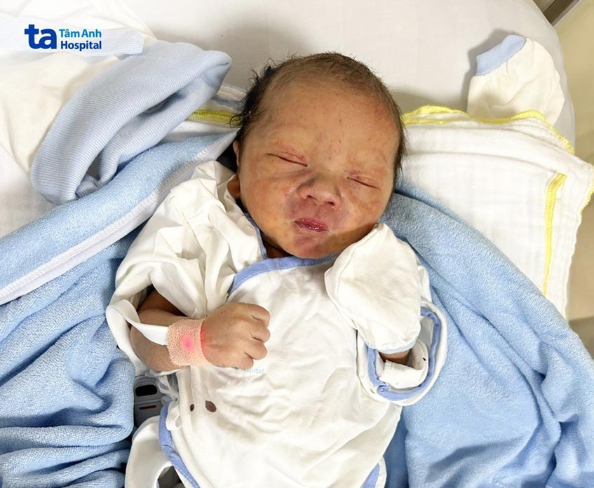 Bé trai vàng da, nổi ban xuất huyết 