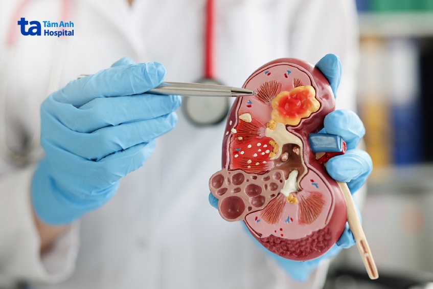 Bên trong thận có chứa các tiểu cầu thận