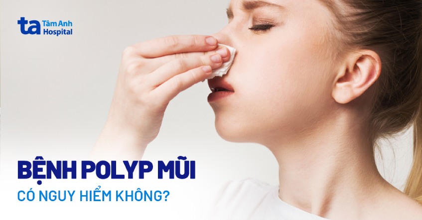 bệnh polyp mũi có nguy hiểm không
