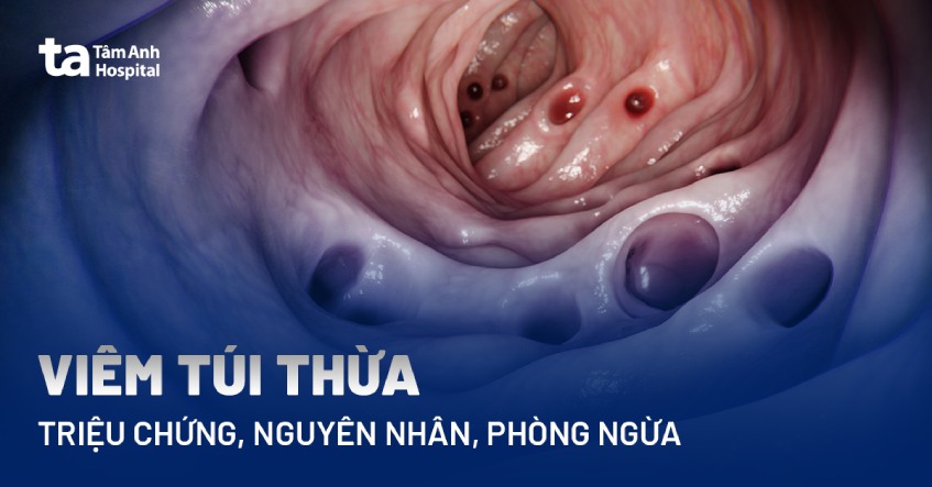 bệnh viêm túi thừa