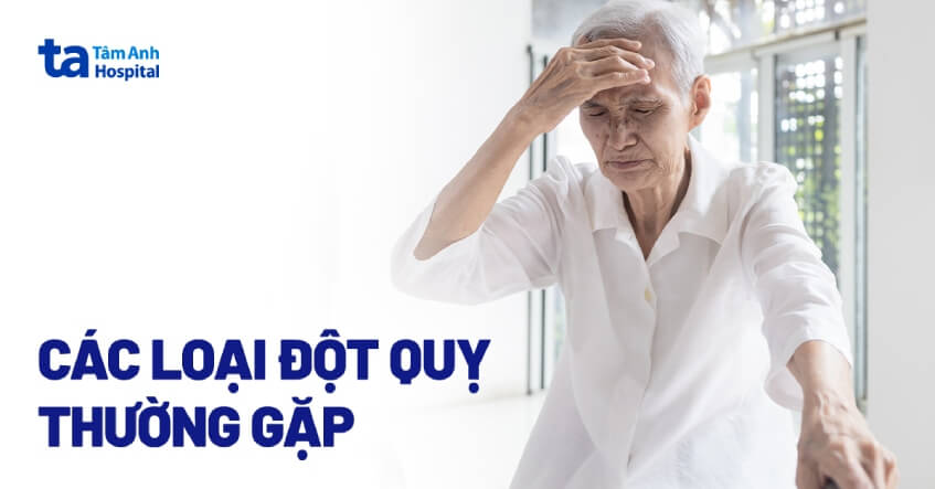 Các loại đột quỵ: Cách phân biệt các dạng phổ biến nhất hiện nay