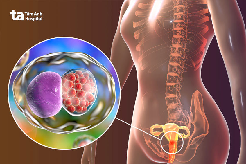 các tác nhân gây viêm nhiễm âm đạo