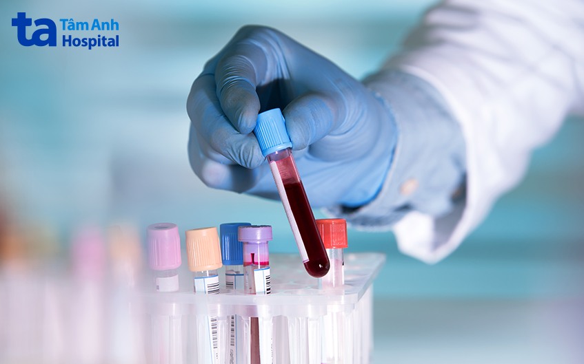 chẩn đoán bệnh não gan