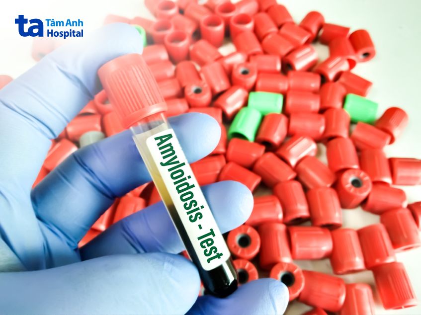 chẩn đoán bệnh thận bột