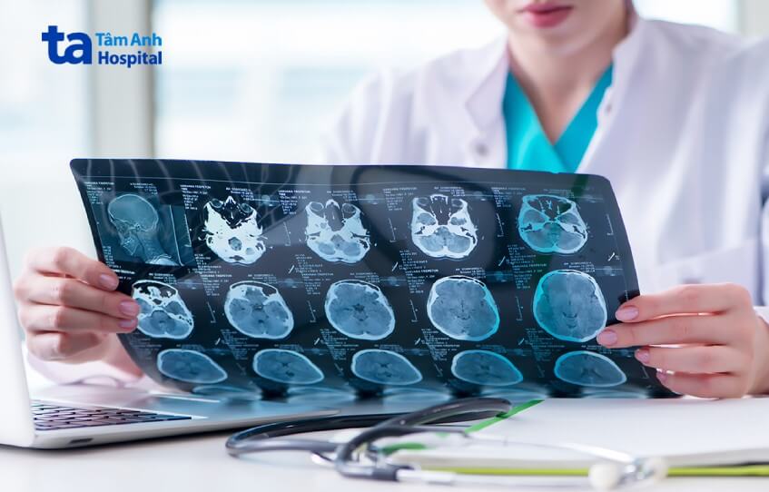chẩn đoán nhiễm trùng vết mổ sọ não