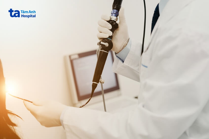 chẩn đoán ung thư thanh quản giai đoạn 2