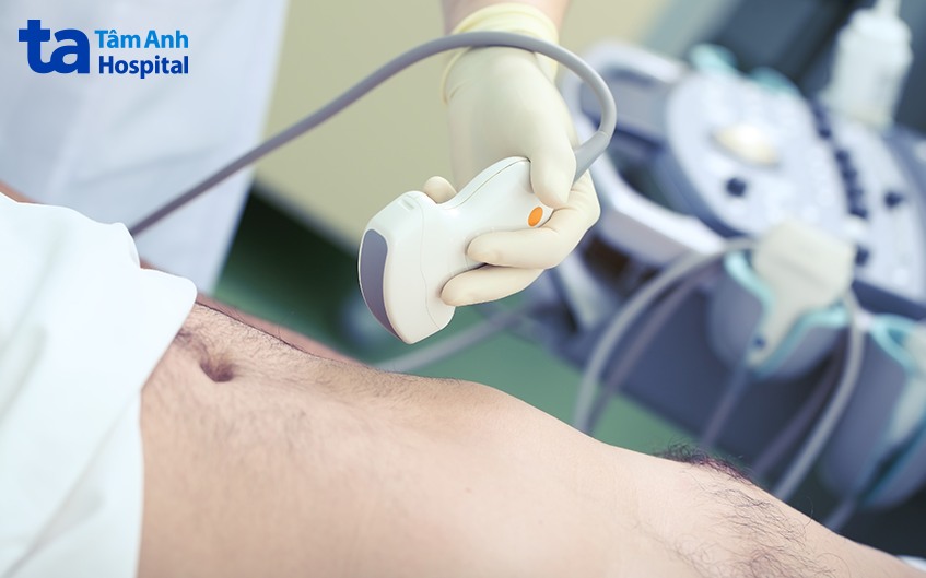 chẩn đoán viêm túi mật cấp