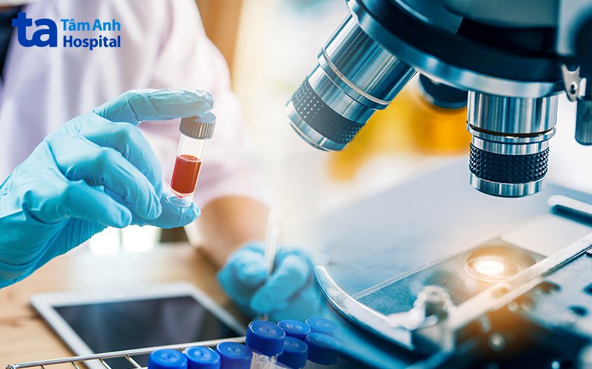 chẩn đoán viêm túi thừa