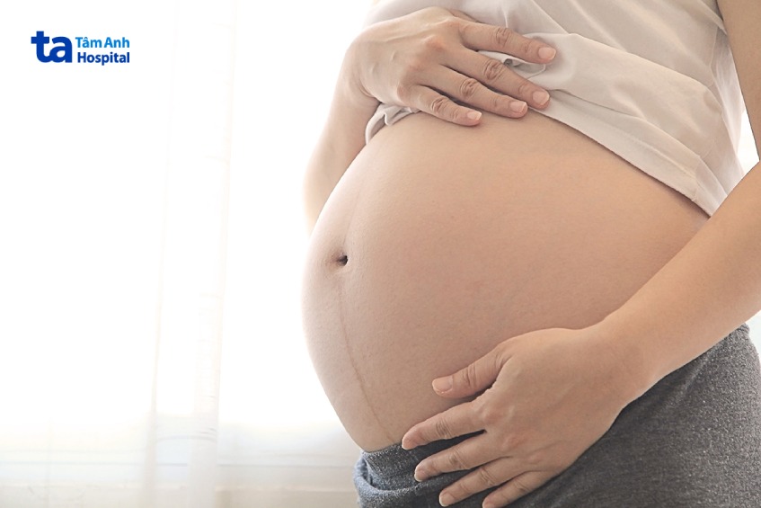 không chụp x quang sỏi thận cho người mang thai