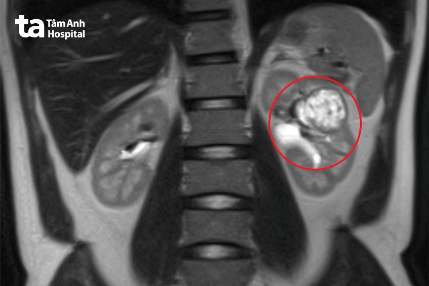 chụp x quang chẩn đoán
