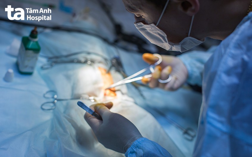 điều trị viêm túi thừa