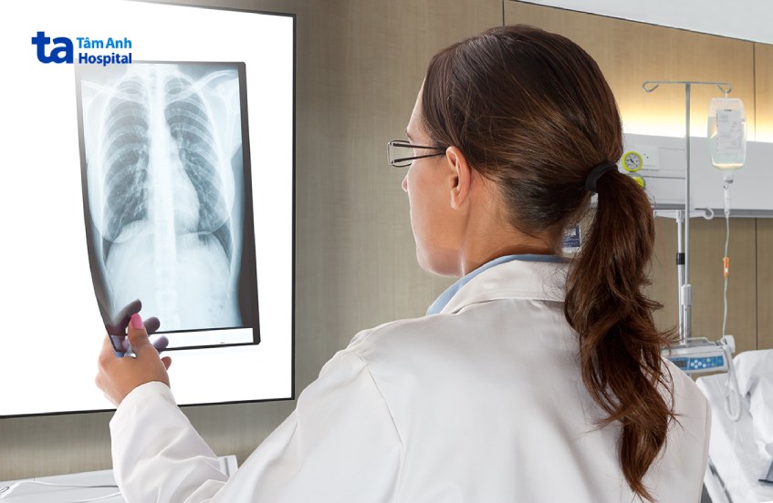 đọc kết quả xquang tràn dịch màng phổi