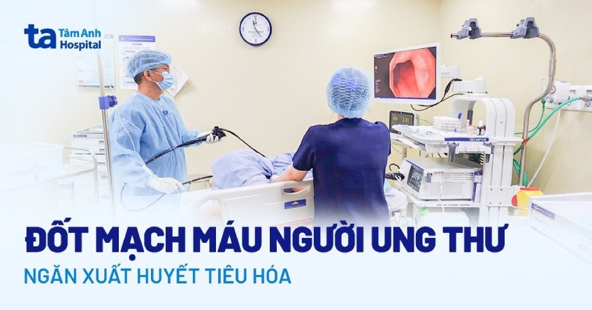 Đốt mạch máu người ung thư ngăn xuất huyết tiêu hóa