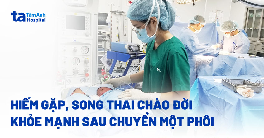 Hiếm gặp song thai chào đời khỏe mạnh 