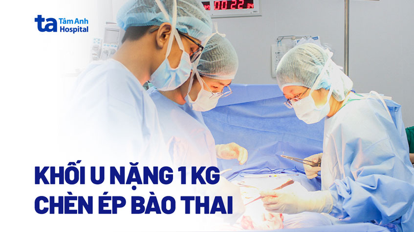 Khối u 1 kg chèn ép bào thai trong bụng mẹ