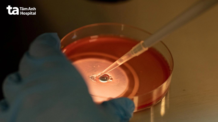 Kỹ thuật viên thụ tinh ống nghiệm