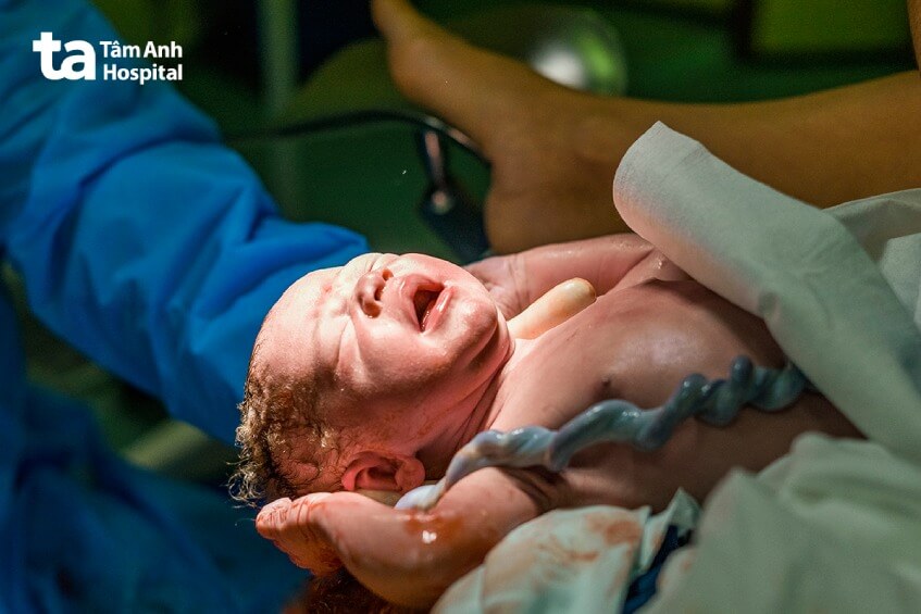 lưu trữ cuống rốn để làm gì