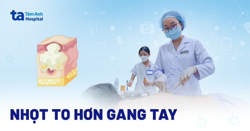 Mụn nhọt to hơn gang tay, rỉ mủ ướt áo