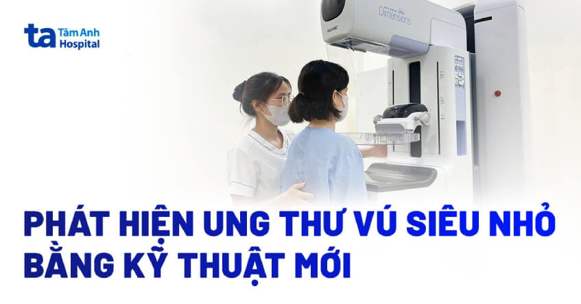 Phát hiện ung thư vú siêu nhỏ bằng kỹ thuật mới