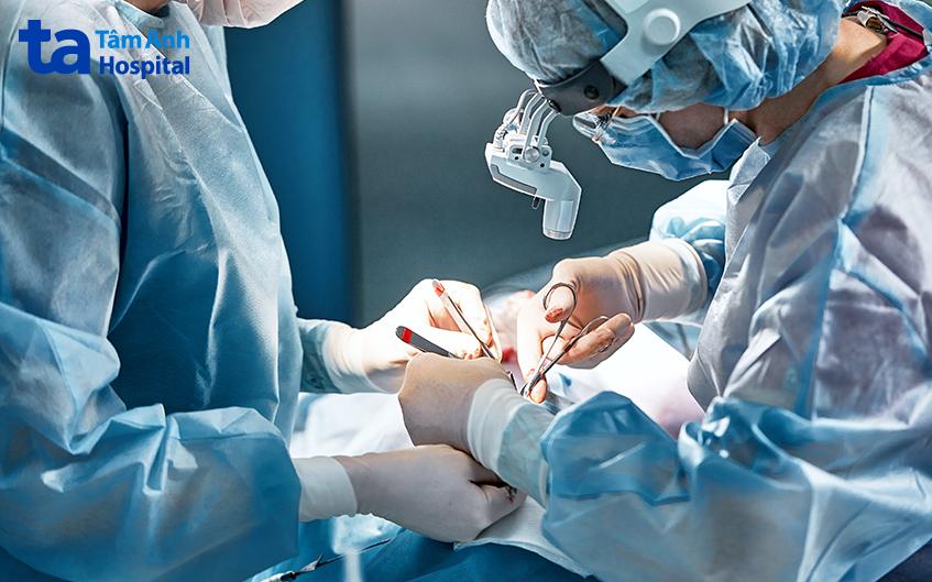 phẫu thuật cắt sỏi túi mật