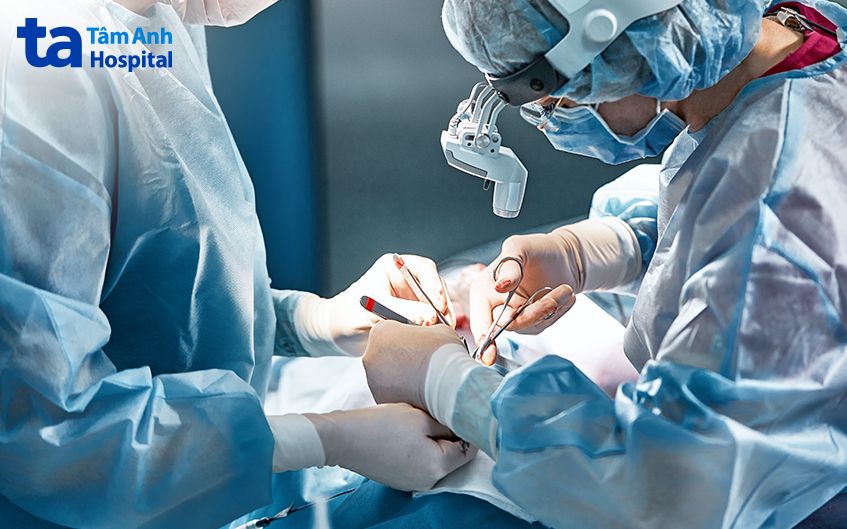 phẫu thuật chữa sỏi túi mật