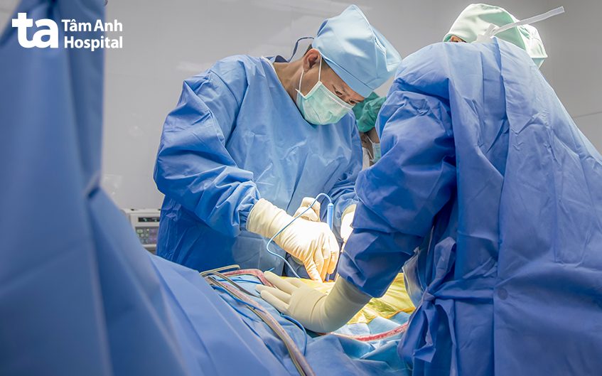 phẫu thuật polyp túi mật