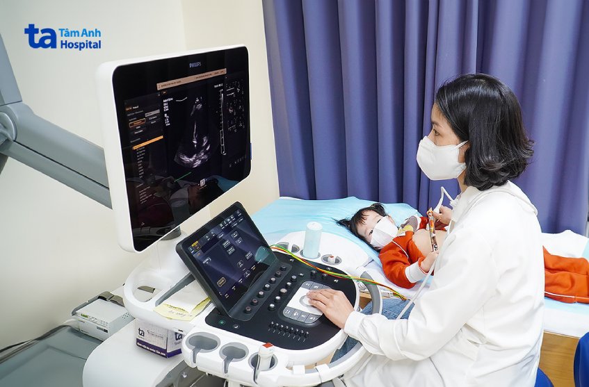 Siêu âm tim cho trẻ tại Bệnh viện Đa khoa Tâm Anh