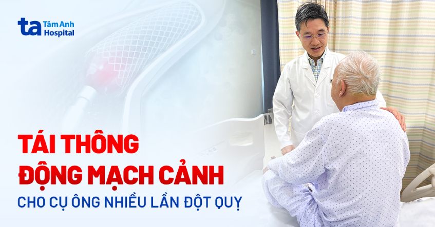 Tái thông động mạch cảnh cho cụ ông nhiều lần đột quỵ