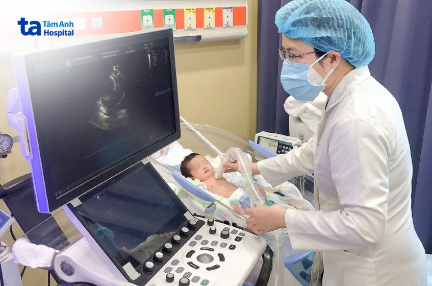 Tầm soát dị tật tim bẩm sinh sau sinh được thực hiện 24-48h sau sinh